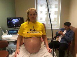 amy schumer incinta 04.jpg